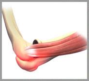 Elbow Sprain