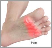 Forefoot Pain