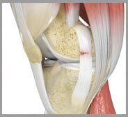 Ligament Injuries 