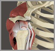 Rotator Cuff Tear